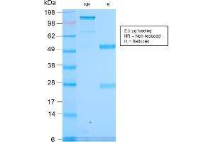Image no. 4 for anti-Spectrin alpha 1, Erythrocytic (SPTA1) (AA 356-475) antibody (ABIN6940646)