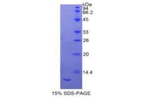 Image no. 1 for S100 Calcium Binding Protein A11 (S100A11) (AA 9-98) protein (His tag) (ABIN1877850)