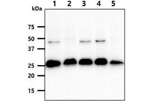 Image no. 1 for anti-SSU72 RNA Polymerase II CTD Phosphatase Homolog (SSU72) antibody (ABIN5776256)