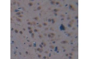 Image no. 3 for anti-Protein L-Myc (MYCL) (AA 257-394) antibody (ABIN1171696)