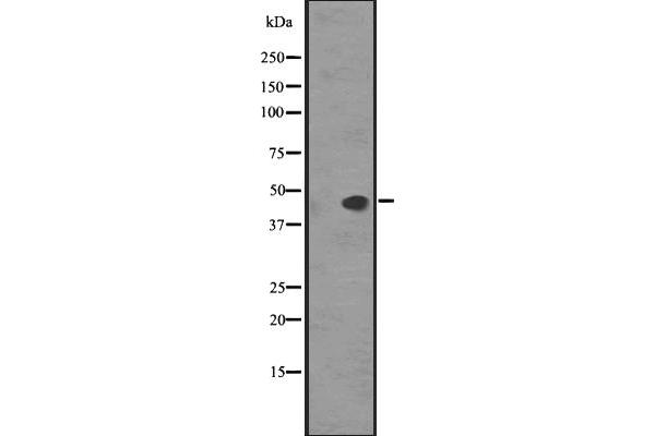 anti-Somatostatin Receptor 5 (SSTR5) (Internal Region) antibody