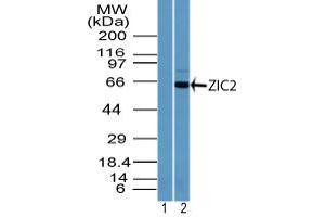 Image no. 1 for anti-ZIC2 (ZIC2) (AA 350-400) antibody (ABIN960412)