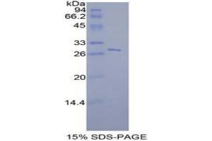 Image no. 1 for Signal Transducer and Activator of Transcription 6, Interleukin-4 Induced (STAT6) protein (ABIN3011670)