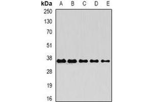 Image no. 2 for anti-O-Sialoglycoprotein Endopeptidase (OSGEP) antibody (ABIN2966862)
