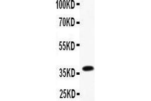 FCER2 antibody  (AA 50-331)