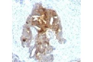Image no. 1 for anti-Temporarily Assigned Gene Name Family Member (TAG-72) antibody (ABIN3026694)