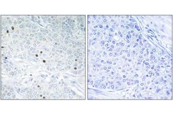 anti-Tumor Protein P53 Inducible Nuclear Protein 2 (TP53INP2) (AA 1-50) antibody