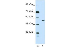 Image no. 1 for anti-Bromodomain Containing 3 (BRD3) (N-Term) antibody (ABIN2780846)