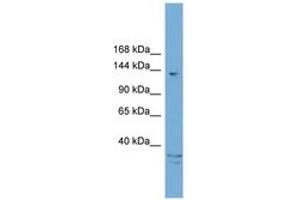 ARID5B Antikörper  (AA 1031-1080)