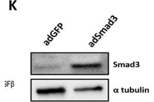 Image no. 9 for anti-alpha Tubulin (TUBA1) (C-Term) antibody (ABIN964563)