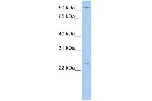 Image no. 1 for anti-Oxysterol Binding Protein-Like 8 (OSBPL8) (N-Term) antibody (ABIN2781875)