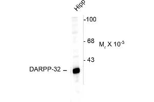 Image no. 1 for anti-Protein Phosphatase 1, Regulatory (Inhibitor) Subunit 1B (PPP1R1B) (N-Term) antibody (ABIN361423)