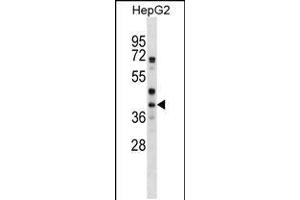 Image no. 1 for anti-Wingless-Type MMTV Integration Site Family, Member 6 (WNT6) (AA 173-201) antibody (ABIN5534827)