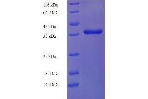 Image no. 1 for Nuclear Import 7 Homolog (NIP7) (AA 1-180), (full length) protein (His-SUMO Tag) (ABIN5712007)
