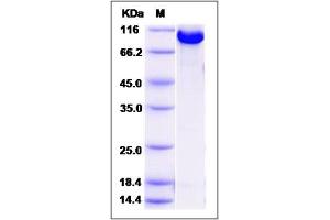 Image no. 1 for Ribonucleotide Reductase M1 (RRM1) (AA 1-792) protein (GST tag,His tag) (ABIN2006145)