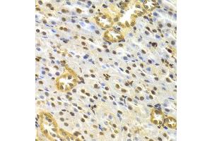 Image no. 2 for anti-Tumor Protein P63 (TP63) antibody (ABIN3023012)