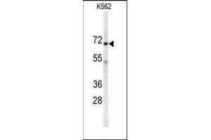 Image no. 1 for anti-Adenylate Kinase 7 (AK7) (C-Term) antibody (ABIN359166)