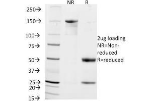 Image no. 4 for anti-Neural Cell Adhesion Molecule 1 (NCAM1) antibody (ABIN6940173)