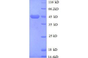 Image no. 1 for Insulin-Like Growth Factor 2 Receptor (IGF2R) (AA 2328-2491), (partial) protein (GST tag) (ABIN1046788)
