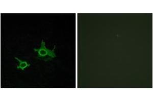 Image no. 2 for anti-Frizzled Family Receptor 3 (FZD3) (AA 141-190) antibody (ABIN1535610)