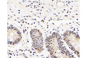 Immunohistochemistry analysis of paraffin-embedded human stomach using Mineralocorticoid receptor Polyclonal Antibody at dilution of 1:300.