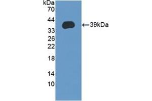 Detection of Recombinant LEAP2, Human using Polyclonal Antibody to Liver Expressed Antimicrobial Peptide 2 (LEAP2)