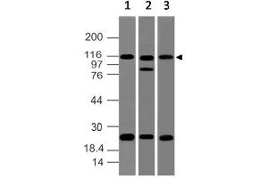 Image no. 1 for anti-NLR Family, Pyrin Domain Containing 2 (NLRP2) (AA 850-1060) antibody (ABIN5027382)
