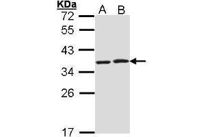 Image no. 5 for anti-HCLS1 Associated Protein X-1 (HAX1) (Center) antibody (ABIN2855251)