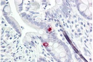 Image no. 1 for anti-Neurotrimin (NTM) (AA 91-140) antibody (ABIN6749729)