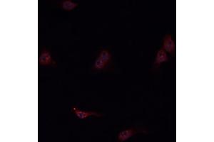 Image no. 2 for anti-Kininogen 1 (KNG1) (N-Term) antibody (ABIN6262859)