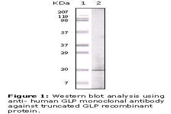 anti-Golgin A6 Family, Member A (GOLGA6A) antibody