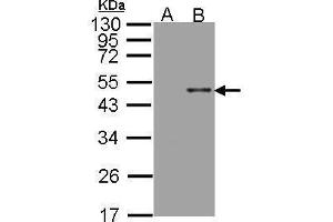 WB Image Western Blot analysis of ARSB expression in transfected 293T cell line by ARSB polyclonal antibody.