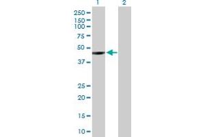 Image no. 1 for anti-Endonuclease VIII-Like 1 (NEIL1) (AA 1-390) antibody (ABIN528991)
