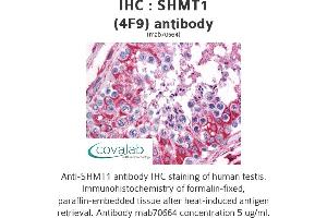 Image no. 1 for anti-serine Hydroxymethyltransferase 1 (Soluble) (SHMT1) (AA 374-483) antibody (ABIN1723521)