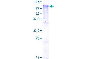 Image no. 1 for NEL-Like 1 (NELL1) (AA 1-810) protein (GST tag) (ABIN1312380)