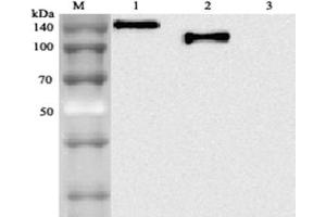 Western blot analysis using anti-ACE2 (human), mAb (AC18F)  at 1: 2,000 dilution.