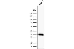 Image no. 1 for anti-B-Cell CLL/lymphoma 2 (BCL2) antibody (ABIN6940502)
