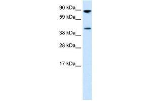 Image no. 1 for anti-Ets Variant 4 (ETV4) (Middle Region) antibody (ABIN2779533)