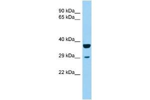 Image no. 1 for anti-Potassium Channel Tetramerisation Domain Containing 1 (KCTD1) (Middle Region) antibody (ABIN2790794)