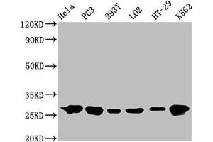 Image no. 2 for anti-Heat Shock 27kDa Protein 1 (HSPB1) antibody (ABIN7127557)