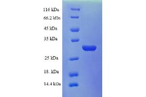 Image no. 1 for Kallikrein B, Plasma (Fletcher Factor) 1 (KLKB1) (AA 391-638), (Light Chain) protein (His tag) (ABIN5709815)