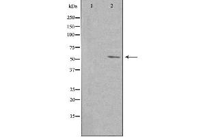 Image no. 1 for anti-Poliovirus Receptor-Related 4 (PVRL4) antibody (ABIN6259166)