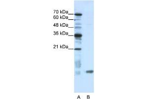 Image no. 2 for anti-SRA Stem-Loop Interacting RNA Binding Protein (SLIRP) (N-Term) antibody (ABIN2776583)