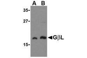 Image no. 2 for anti-G protein beta subunit-like (GBL) antibody (ABIN499879)