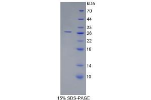 Image no. 1 for ADP-Ribosylation Factor-Like 15 (ARL15) (AA 1-204) protein (His tag) (ABIN6237897)