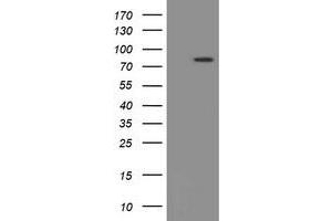 Image no. 1 for anti-Peptidyl Arginine Deiminase, Type IV (PADI4) (AA 299-588) antibody (ABIN1491355)
