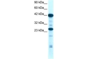 Image no. 1 for anti-SIX Homeobox 6 (SIX6) antibody (ABIN2460444)