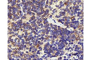 Immunohistochemistry analysis of paraffin-embedded mouse inflammation spleen using INPP5D Polyclonal Antibody at dilution of 1:300.