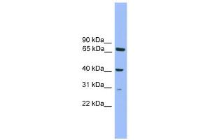 Image no. 1 for anti-Regulatory Factor X-Associated Protein (RFXAP) (N-Term) antibody (ABIN2780101)