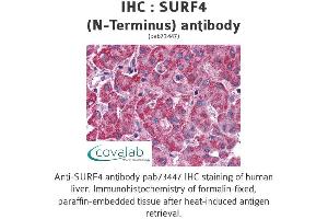 anti-Surfeit 4 (SURF4) (N-Term) antibody